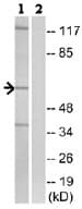 Trp2 Dct Antibody Ab74073  Western Blot Img36291