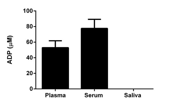 ADP Assay Kit (Colorimetric/Fluorometric)(ab83359)