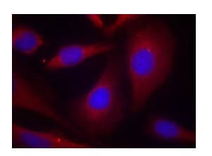 Anti-NFkB p105 / p50 antibody(AB131546)