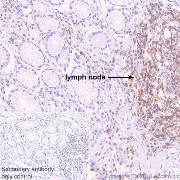 Anti-TREM1 antibody [EPR22060-229](AB225861)