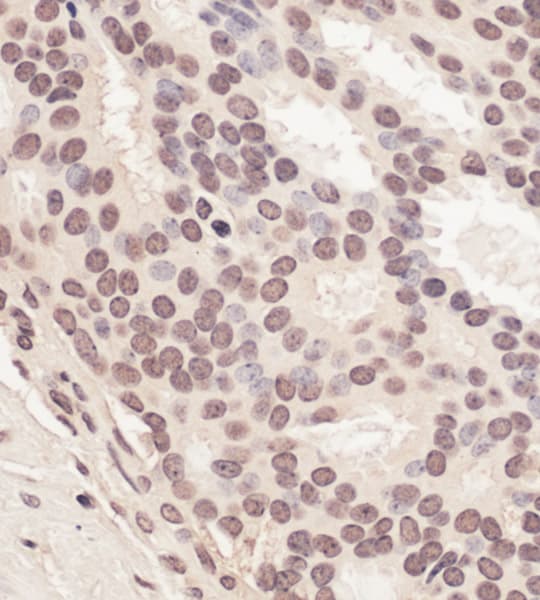 Ring2 Ring1b Rnf2 Antibody Ab101273  Immunohistochemistry Formalin Pfa Fixed Paraffin Embedded Sections Img131693