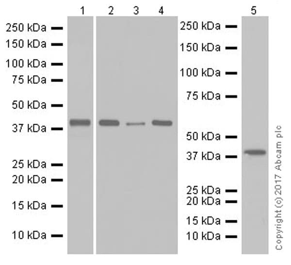 Anti-GNAQ antibody [EPR20978](AB210004)