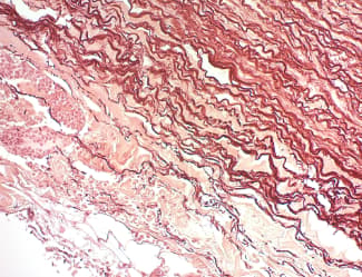 Orcein Stain Kit Hepatitis B And Elastic Fibers Ab245881  Immunohistochemistry Formalin Pfa Fixed Paraffin Embedded Sections Img34316