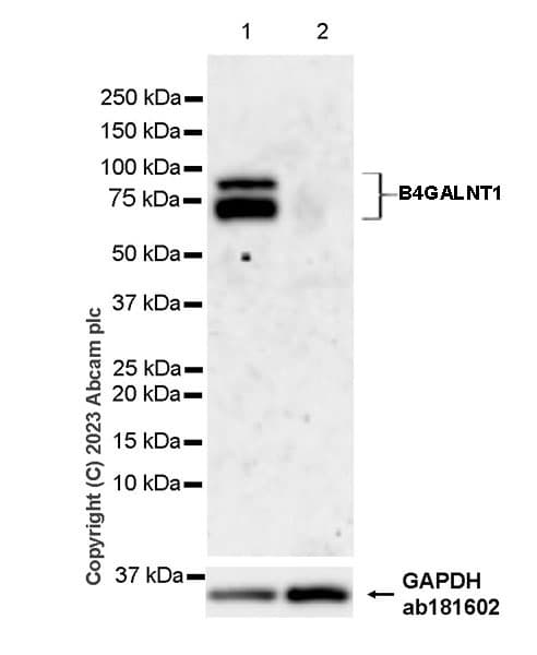 B4galnt1 Antibody Epr28064 64 Ab314130  Western Blot Img419962