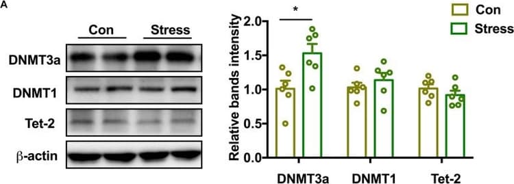 Anti-Dnmt3a antibody [EPR18455](AB188470)