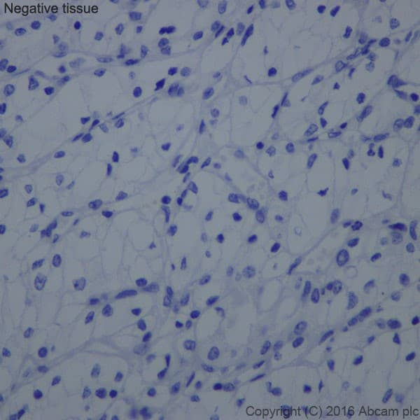 Anti-Uroplakin II/UPII antibody [EPR18799] - BSA and Azide free(AB224261)