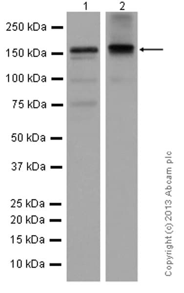 Anti-KDM5B / PLU1 / Jarid1B antibody [EPR12704](AB181089)