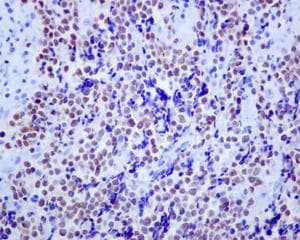 Anti-Islet 1 antibody [EPR10362](AB178400)