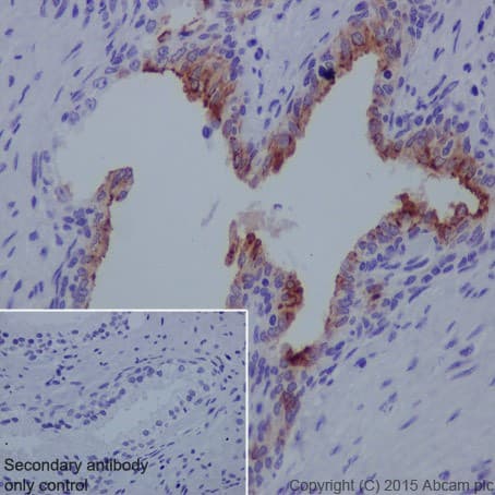 Anti-MMP7 antibody [EPR17888-101](AB205525)