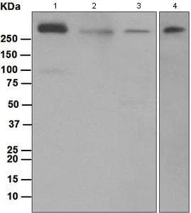 Anti-IP3 receptor antibody [EPR4537](AB108517)