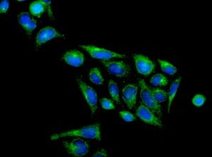 Bicd1 Antibody Epr11642 Bsa And Azide Free Ab249558  Immunocytochemistry Immunofluorescence Img101505