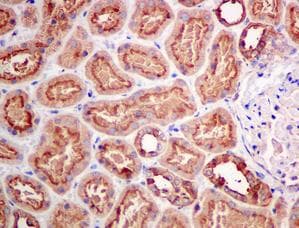 Anti-ATP6V1D antibody [EPR11326(B)](AB157458)