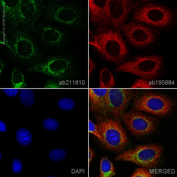 Alexa Fluor 555 Trk Fused Gene Antibody Epr8766 Ab211610  Immunocytochemistry Immunofluorescence Img13276