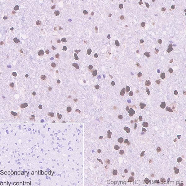 Anti-TDP43 antibody [EPR5810](AB109535)