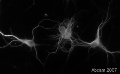 Anti-MAP2 antibody [AP-20](AB11268)