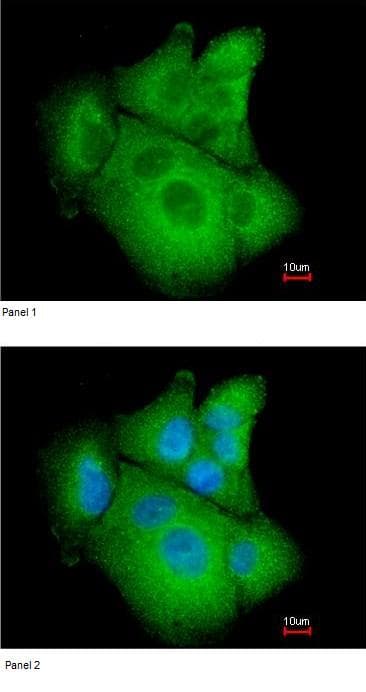 Anti-Phosphoserine Aminotransferase antibody(AB96136)