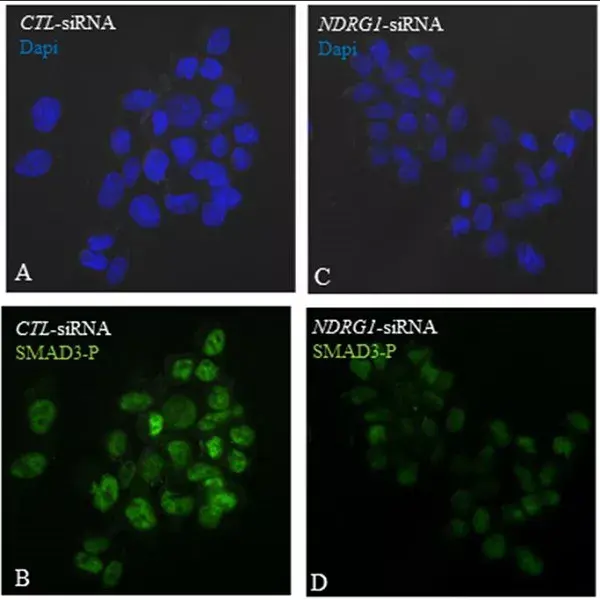 Anti-SMAD3 (pS423/425) + SMAD5 (pS463/465 ) + SMAD1 (pS463/465) + SMAD2 (pS465/467) antibody [EP823Y](AB52903)