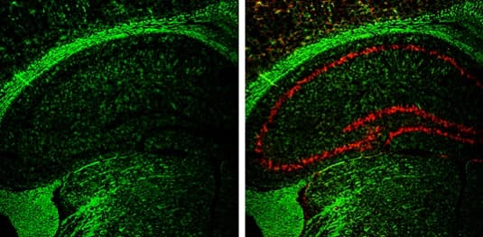 Anti-CNPase antibody(AB227218)