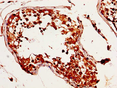 Bcg1 Antibody Ab236592  Immunohistochemistry Formalin Pfa Fixed Paraffin Embedded Sections Img23119