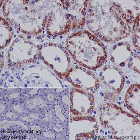 Anti-STAT6 antibody [YE361](AB32520)