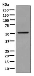 Glucokinase Antibody Epr10374 Bsa And Azide Free Ab249216  Western Blot Img86412