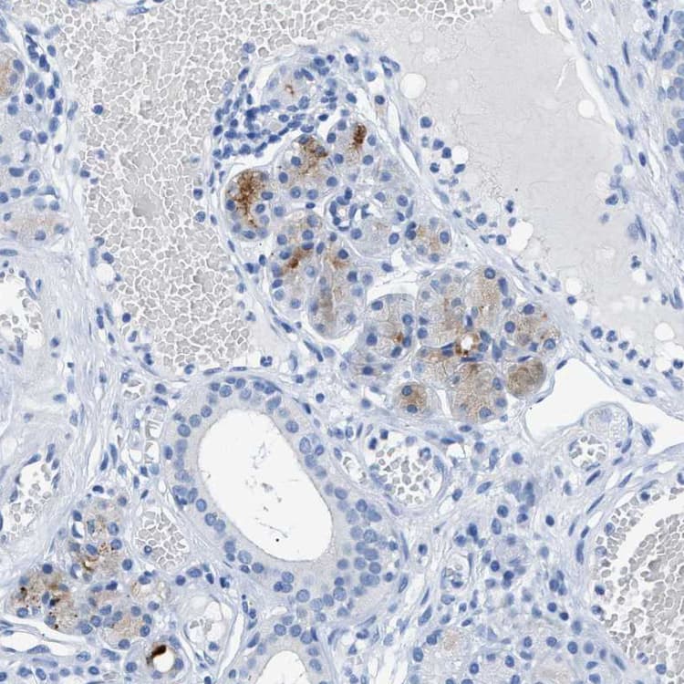 Fdcsp Antibody Ab121420  Immunohistochemistry Formalin Pfa Fixed Paraffin Embedded Sections Img185840