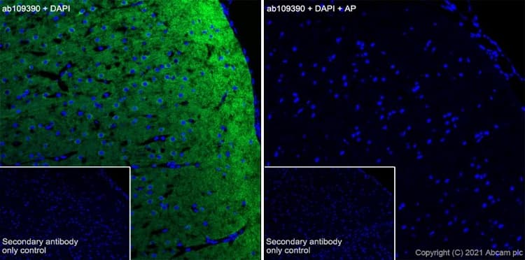 Anti-Tau (phospho S396) antibody [EPR2731](AB109390)