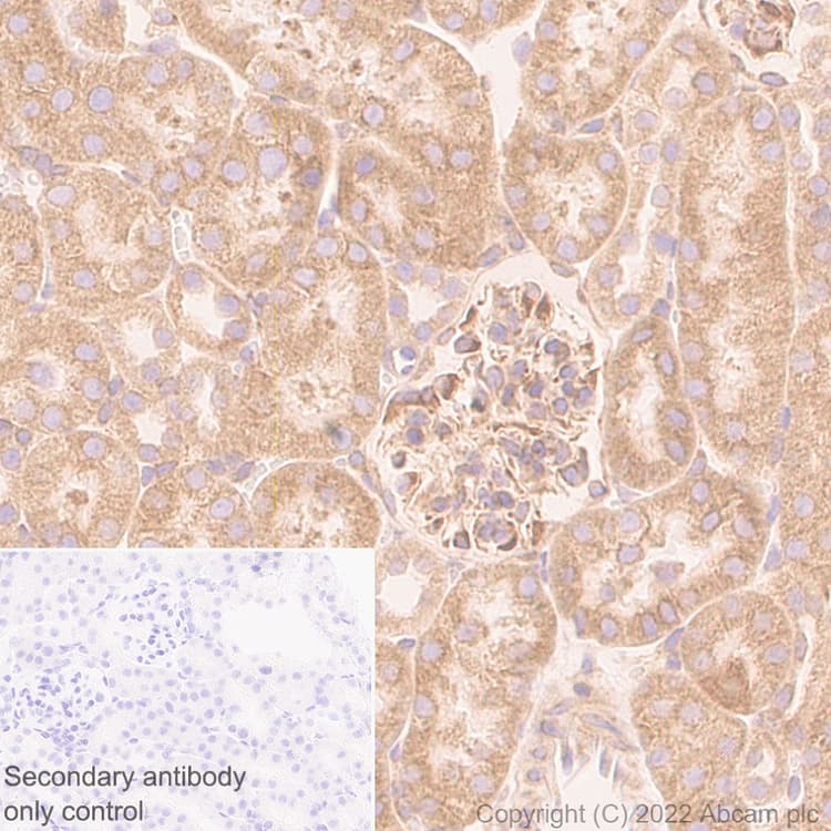 Anti-VAPB antibody [EPR27026-50](AB315013)