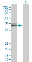 Ab94149  Western Blot Img145433