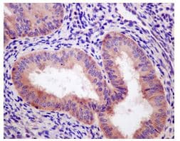 Anti-Ribosomal protein S11/RPS11 antibody [EPR11487](AB175213)