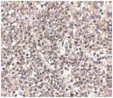 Anti-RSPO1 antibody(AB106556)