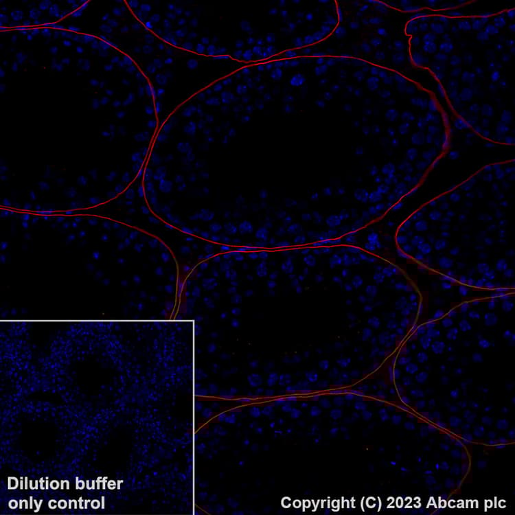 Alexa Fluor® 647 Anti-LAMA1 antibody [EPR27258-37](ab315852)