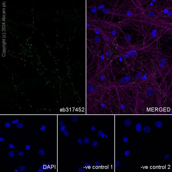 Anti-VAChT antibody [EPR29154-71](AB317452)