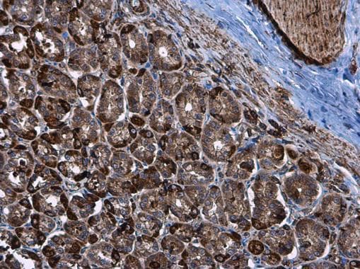 Anti-Hexokinase II antibody(AB227198)