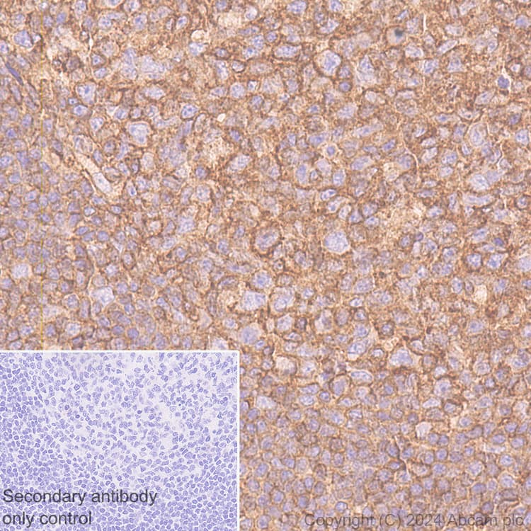 Anti-HLA Class 1 abC antibody [EMR8-5](ab70328)