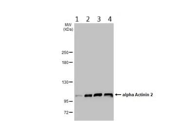 Anti-Sarcomeric Alpha Actinin antibody(AB137346)