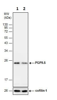Anti-PGP9.5 antibody(AB227157)