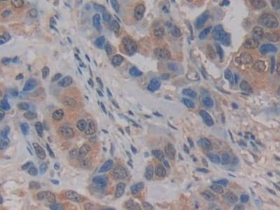 Anti-Kallikrein 2/KLK2 antibody(ab232980)