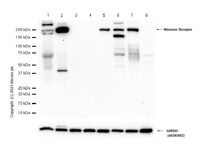 Anti-Mannose Receptor antibody [EPR25215-277](AB300621)