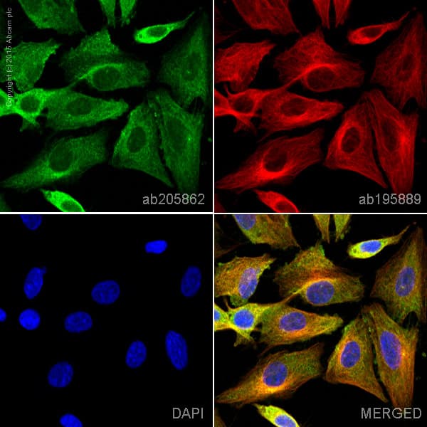 Alexa Fluor 488 Camkii Antibody Epr66862 Ab205862  Immunocytochemistry Immunofluorescence Img47288