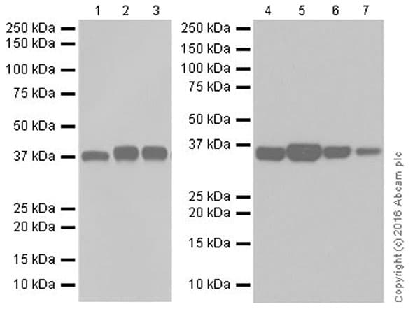 Anti-Aldolase+Aldolase C antibody [EPR19355] - BSA and Azide free(AB251296)