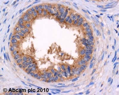 Met Enkephalin Antibody Ab22620  Immunohistochemistry Formalin Pfa Fixed Paraffin Embedded Sections Img108589