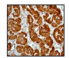 Anti-ACTC1 antibody [EP184E](AB46805)