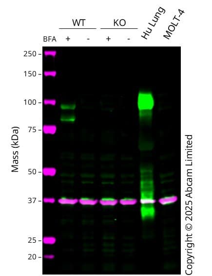 Anti-MMP9 antibody [EP1254](AB76003)