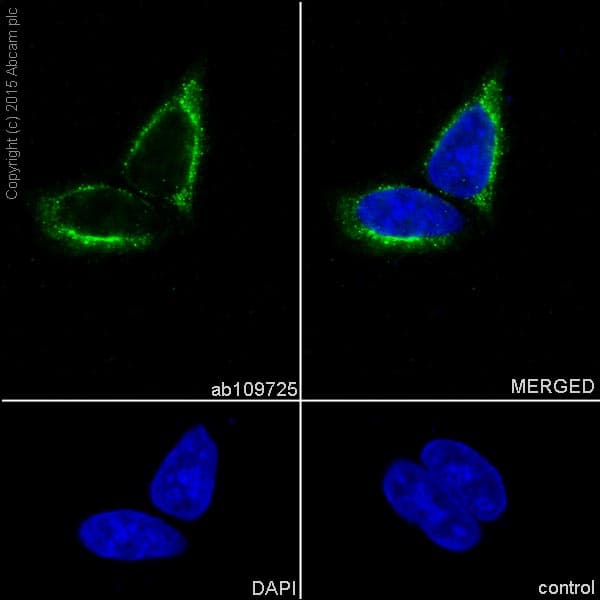 Cytokeratin 17 Antibody Ep1623 Bsa And Azide Free Ab239986  Immunocytochemistry Immunofluorescence Img63606