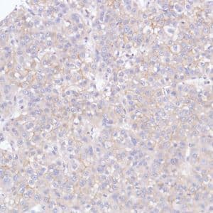 Anti-FGFR2 antibody [SP273] - BSA and Azide free(AB272012)