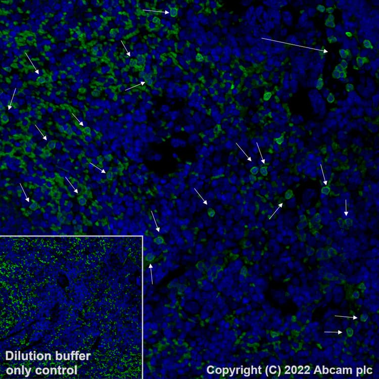 Alexa Fluor® 488 Anti-S100A9 antibody [EPR22332-75](AB307395)