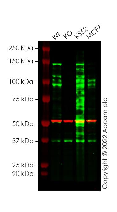 Anti-abL1 antibody [EPR23406-32](ab254341)