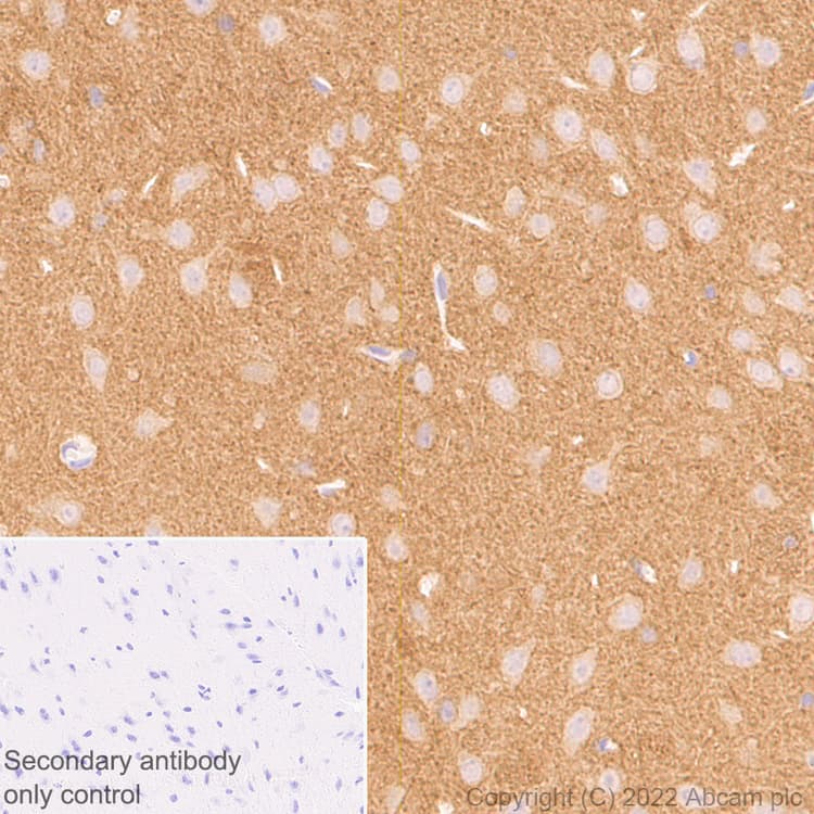 Anti-PAK1 antibody [EPR26067-45](AB302506)