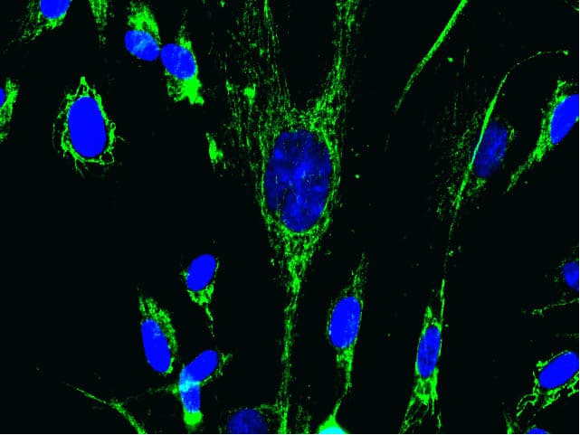 Anti-MTCO2 antibody [12C4F12](AB110258)